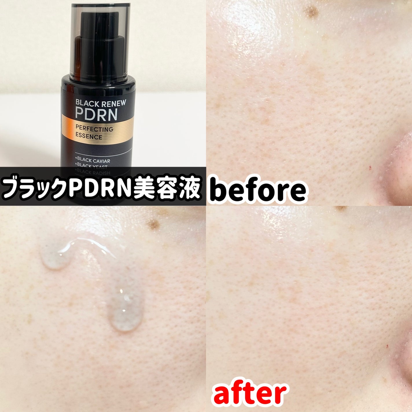 ブラックPDRN 美容液/ネイチャーリパブリック/美容液を使ったクチコミ(5枚目)