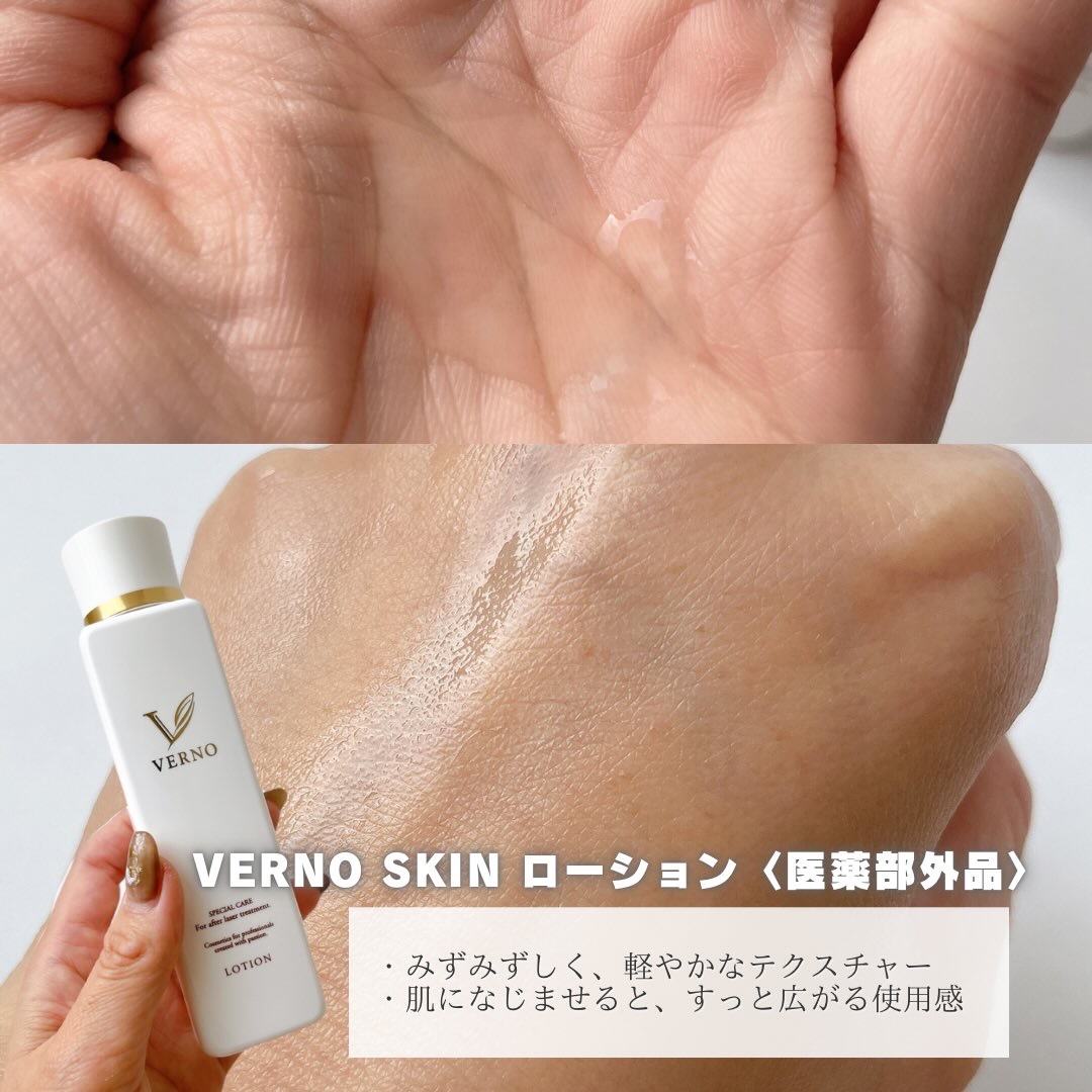 VERNO SKIN ローション〈医薬部外品〉/VERNO SKIN CARE/化粧水を使ったクチコミ（2枚目）