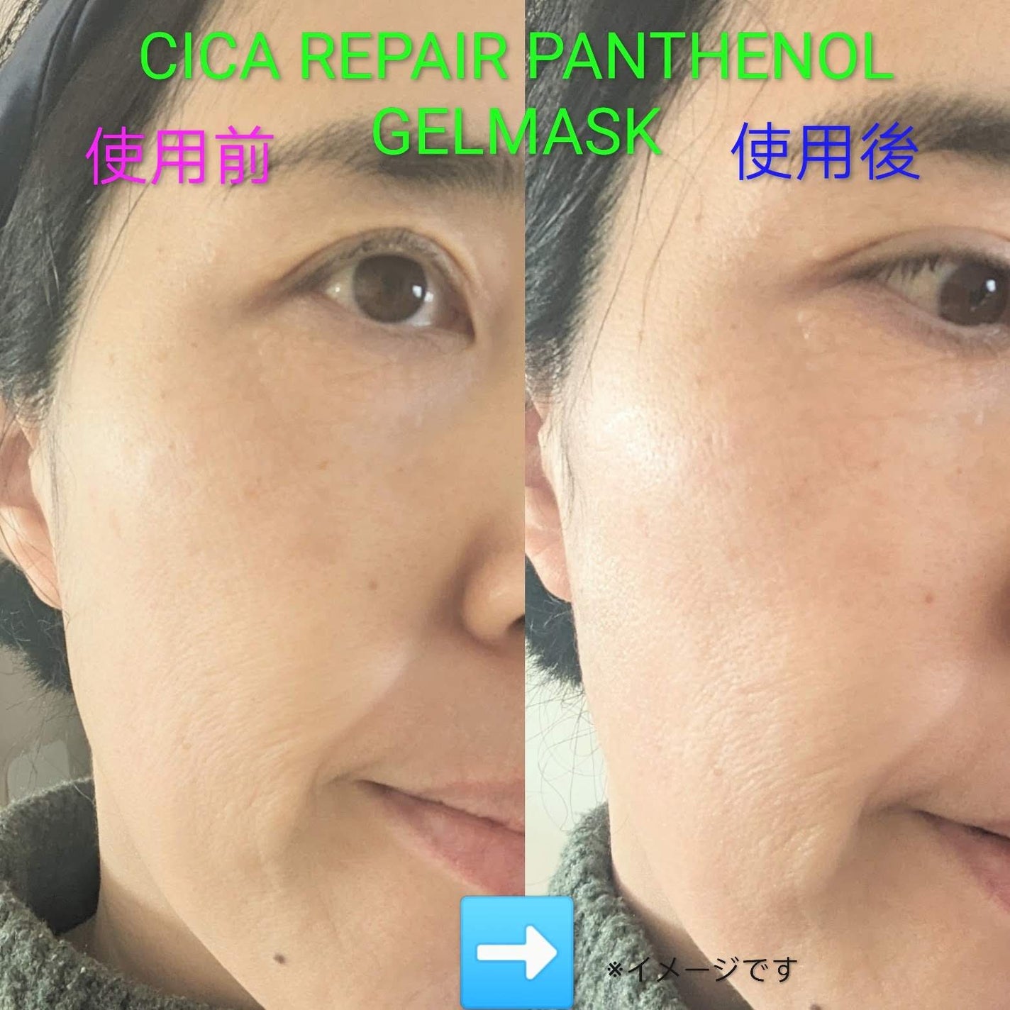 シカリペアパンテノールマスク/AROCELL/シートマスク・パックを使ったクチコミ(6枚目)