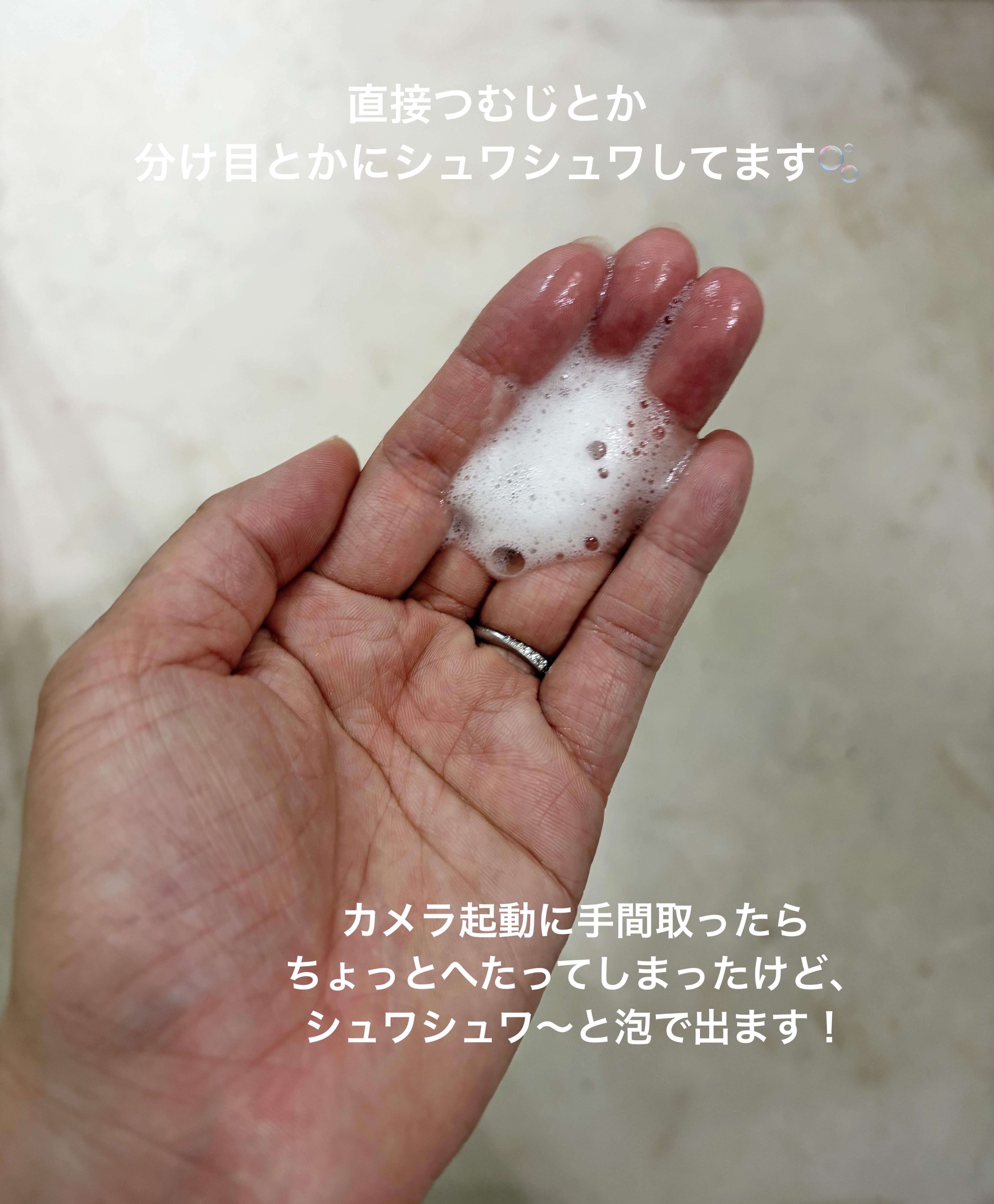 メディケイテッドスカルプフォーム/GROW LAB/頭皮ローションを使ったクチコミ（2枚目）