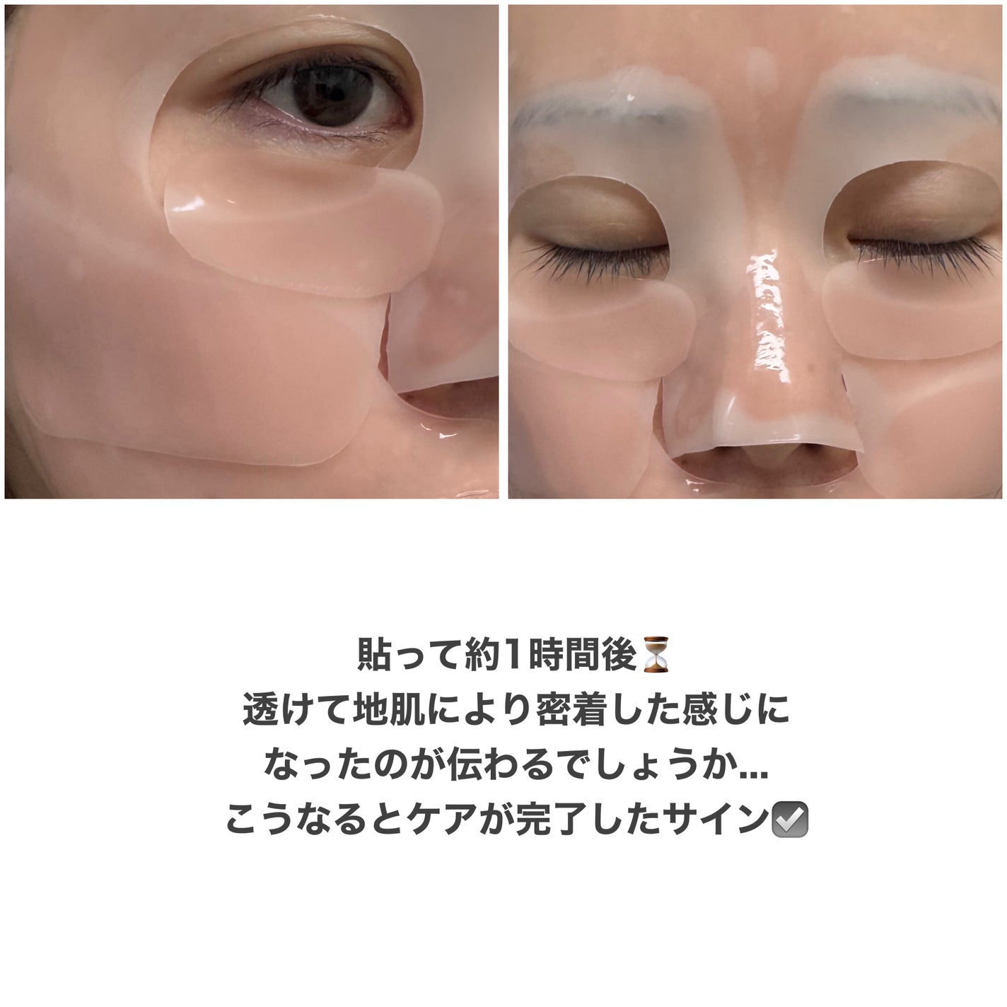 PDRNリジュべネティングフルインハイドロゲルマスク/SAM'U/シートマスク・パックを使ったクチコミ(4枚目)