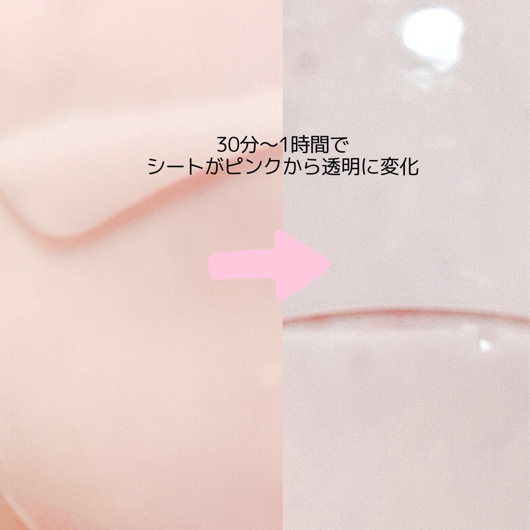 PDRNリジュべネティングフルインハイドロゲルマスク/SAM'U/シートマスク・パックを使ったクチコミ（3枚目）