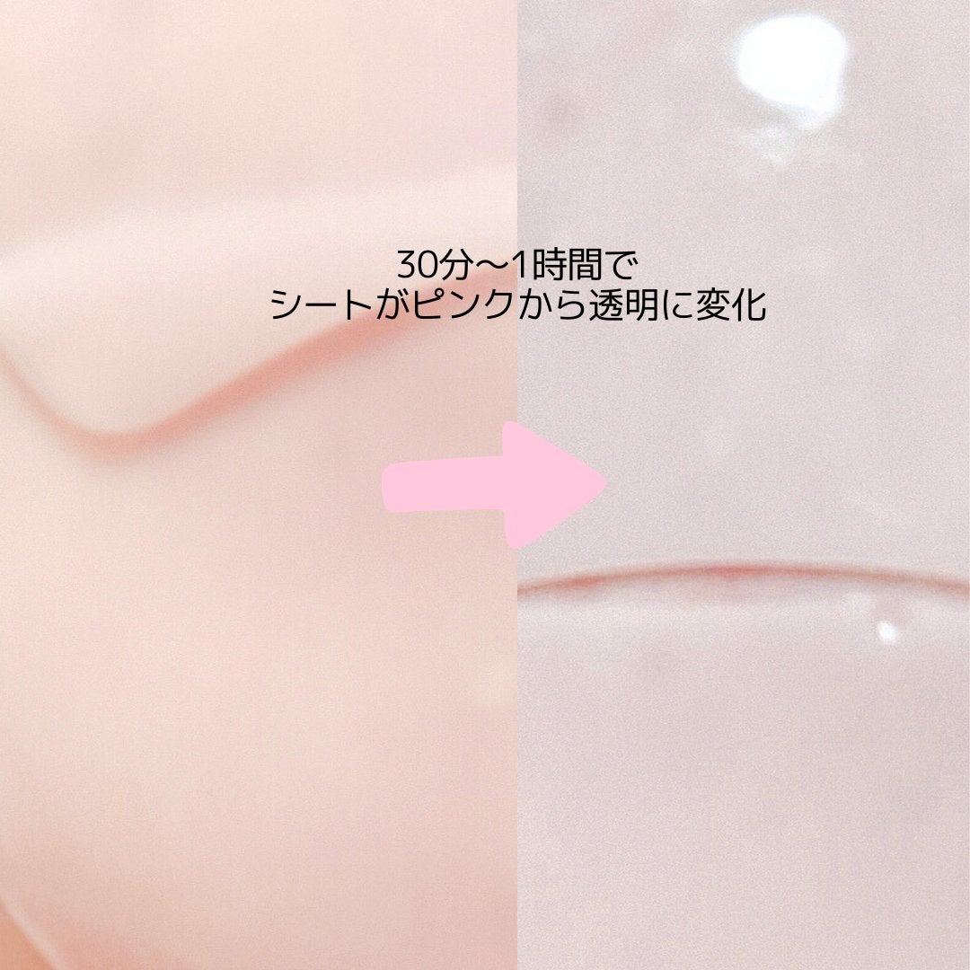 PDRNリジュべネティングフルインハイドロゲルマスク/SAM'U/シートマスク・パックを使ったクチコミ(3枚目)