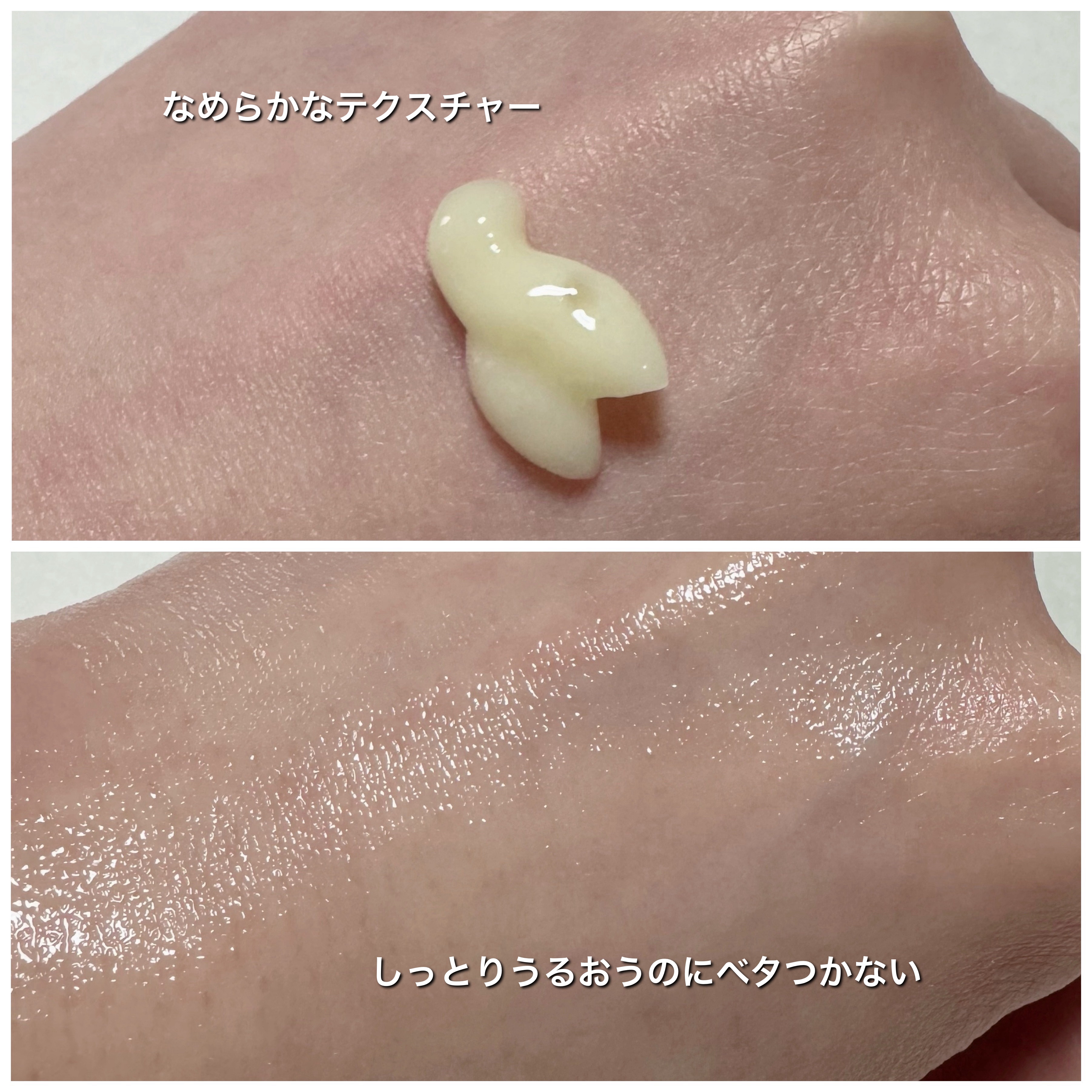 ナイアシンアミド 5% ボディローション/b.clinicx/ボディローションを使ったクチコミ（3枚目）