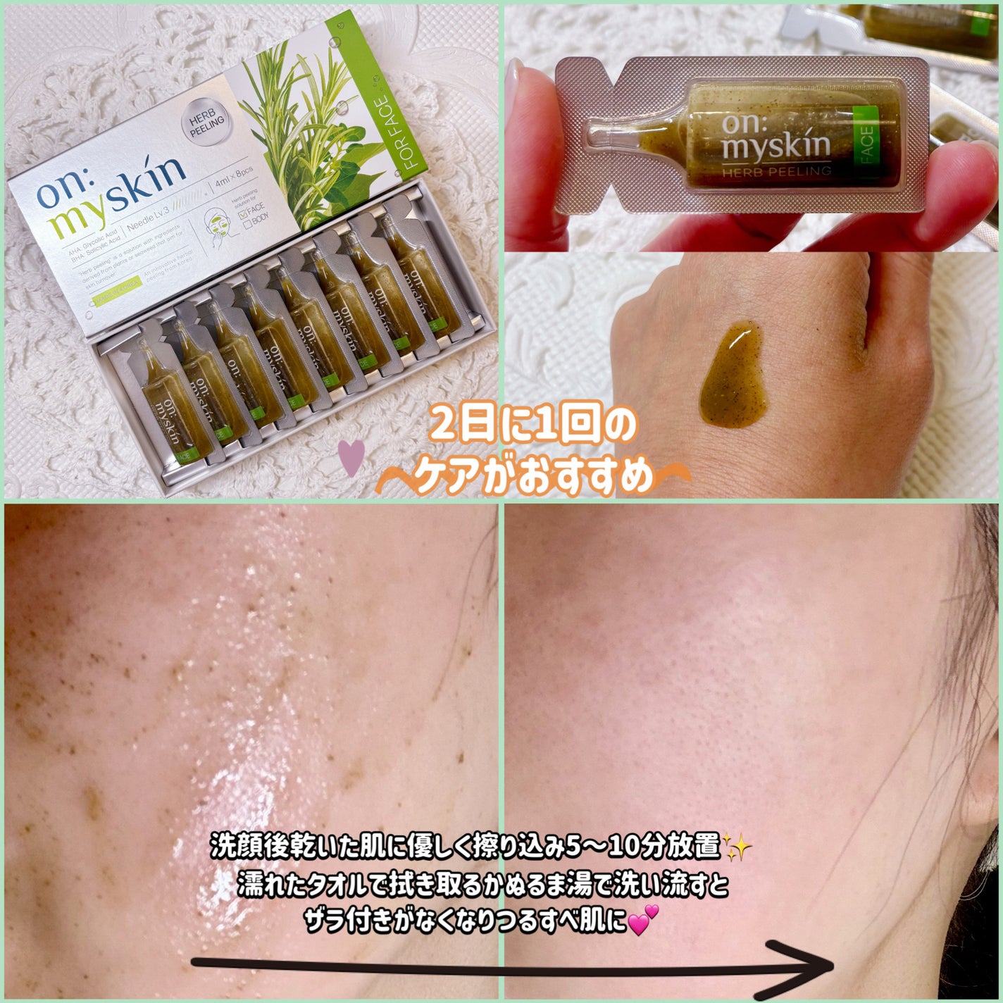 ハーブピーリング/on:myskin/ピーリングを使ったクチコミ(2枚目)