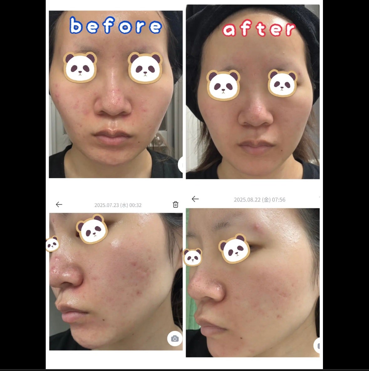 AGE-R ブースタープロ/MEDICUBE/美顔器・マッサージを使ったクチコミ(2枚目)