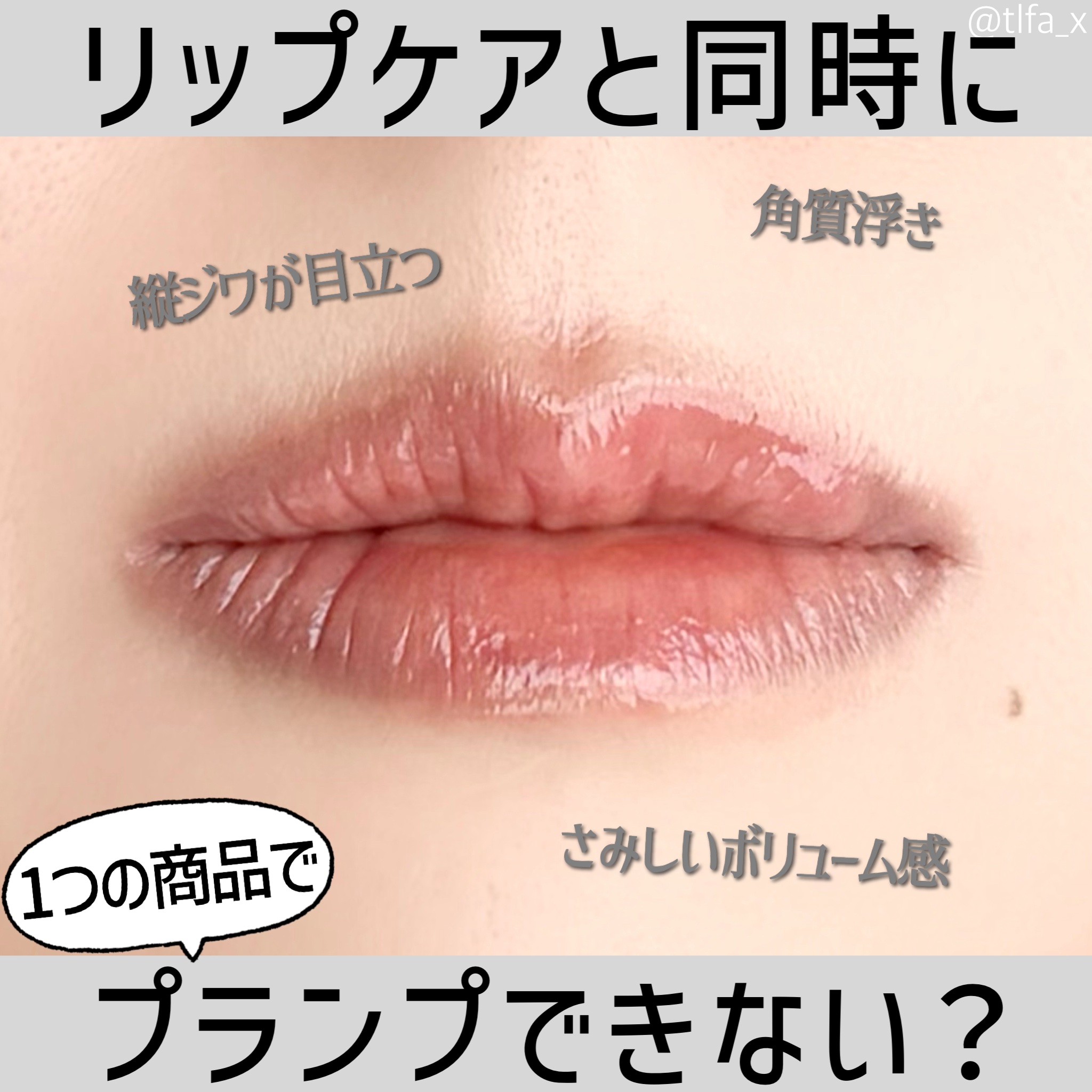 フレイムライトリッププランパー/LoNLy /リッププランパーを使ったクチコミ（1枚目）