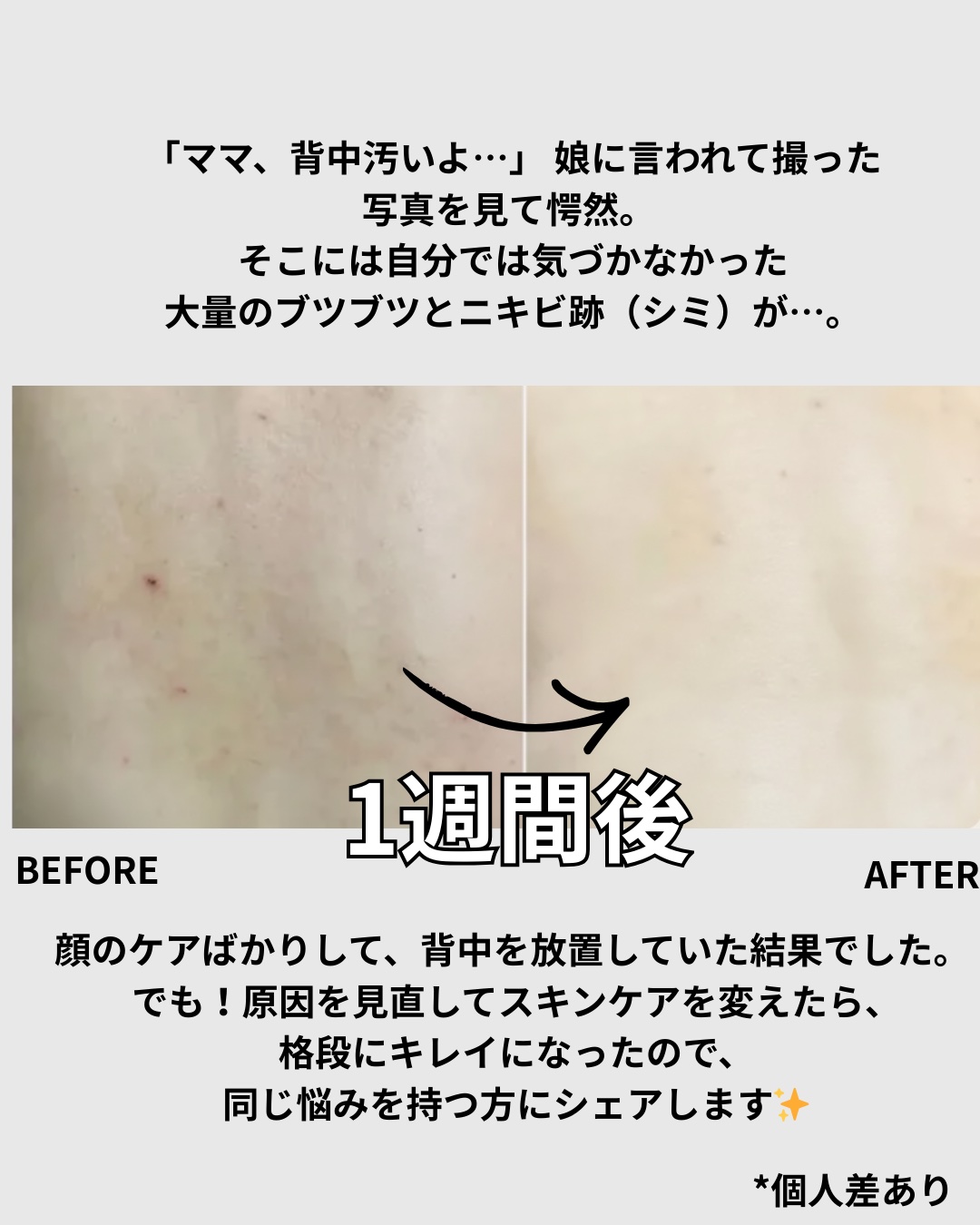 モイストジェルN /HISKIN/ボディローションを使ったクチコミ（2枚目）