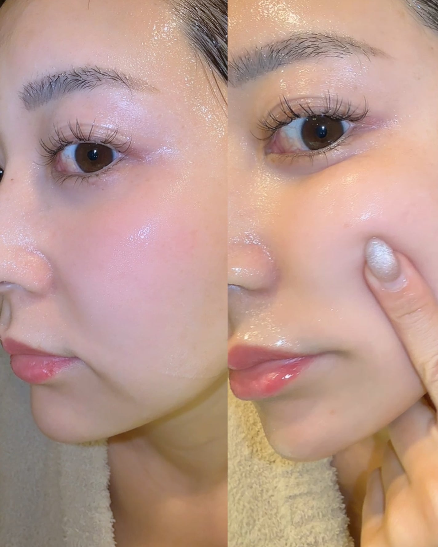 REJURAN ターンオーバーマスク(5枚入り)/REJURAN COSMETICS/シートマスク・パックを使ったクチコミ(3枚目)