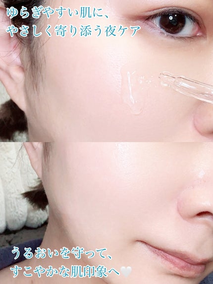 アネトス アクネケア トリートメント セラム/Anetos/美容液を使ったクチコミ(3枚目)