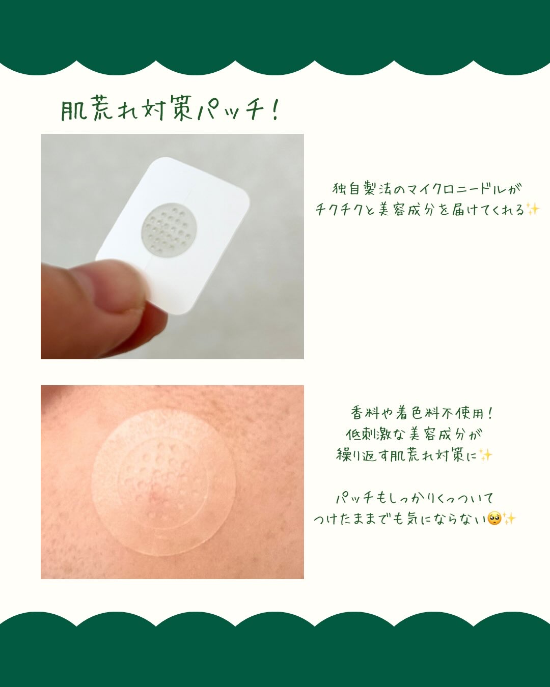 エイシーケアNE/ACROPASS/その他スキンケアを使ったクチコミ（2枚目）