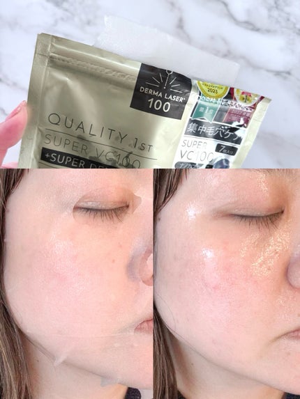 ダーマレーザーEX スーパーVC100マスク/クオリティファースト/シートマスク・パックを使ったクチコミ(2枚目)