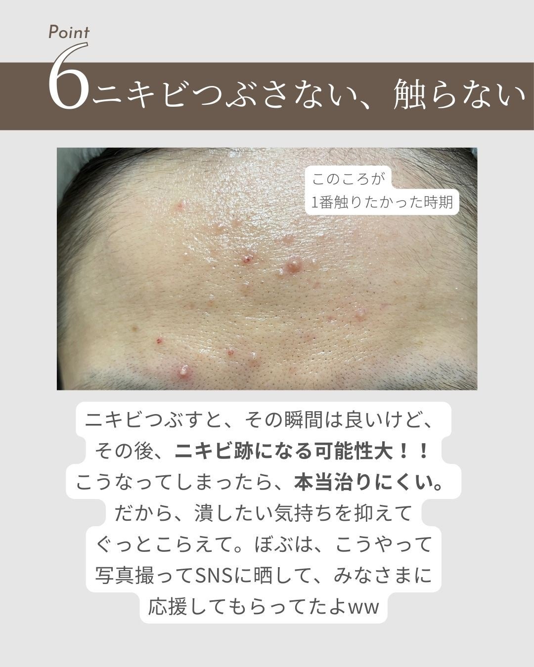 鼻セレブ 洗顔専用/ネピア/クレンジングタオルを使ったクチコミ(8枚目)