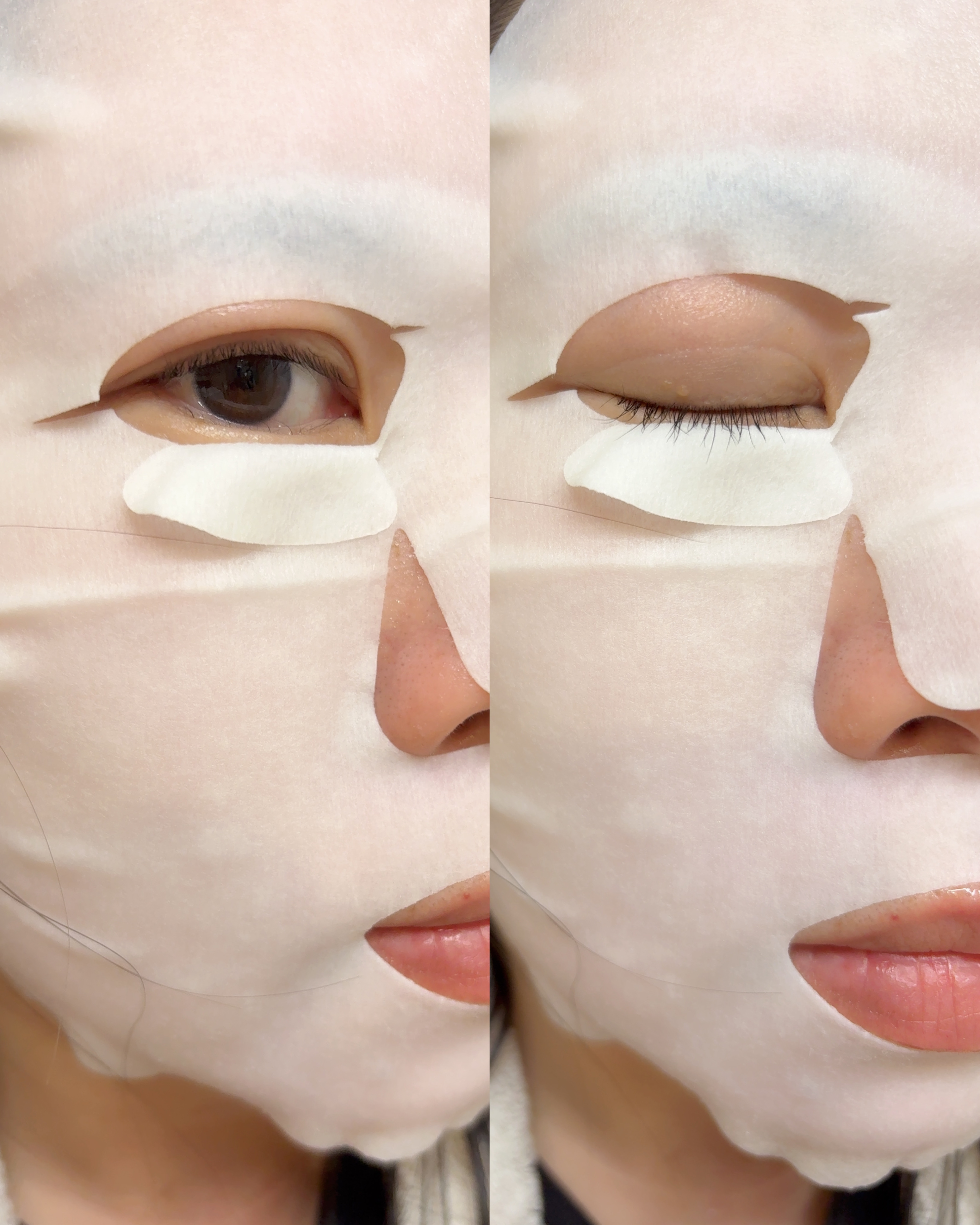 ザ・ダーマベスト 5レチノール+コラーゲン 5枚/クオリティファースト/シートマスク・パックを使ったクチコミ（3枚目）