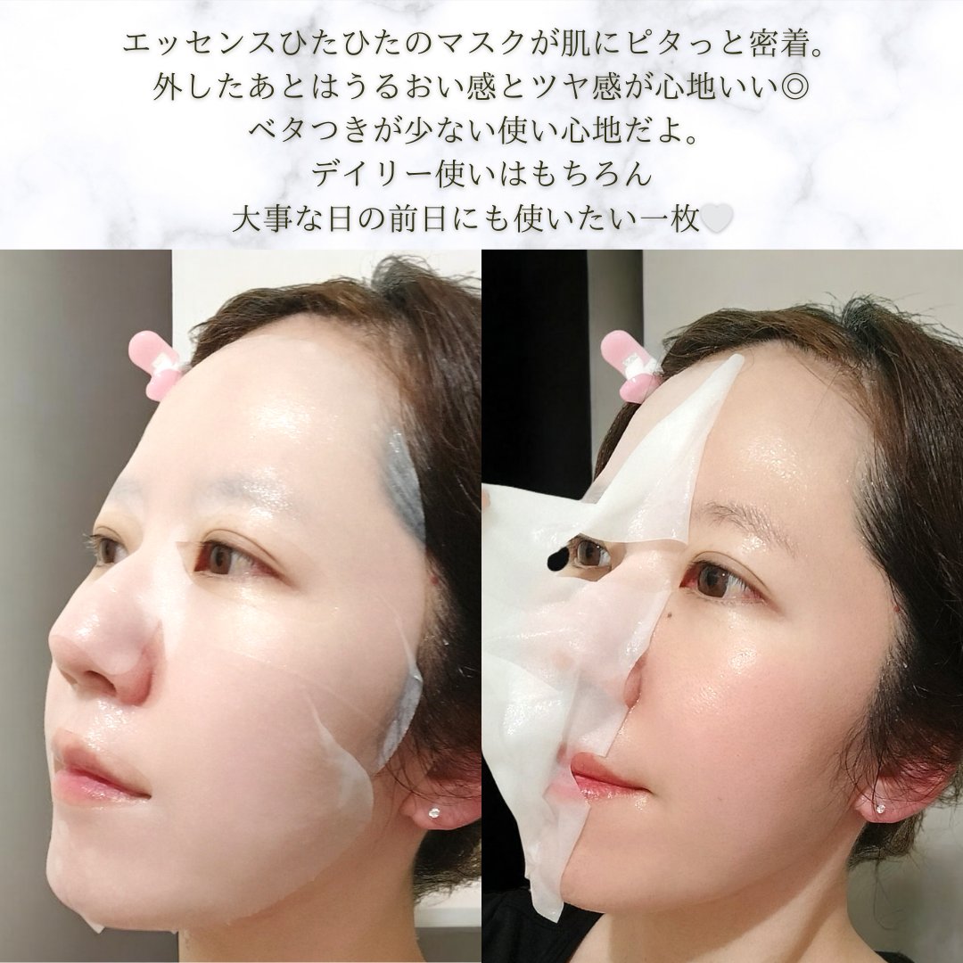 ローゼPDRNエッセンシャルマスクヘルシーグロウ/MEDIHEAL/シートマスク・パックを使ったクチコミ（3枚目）