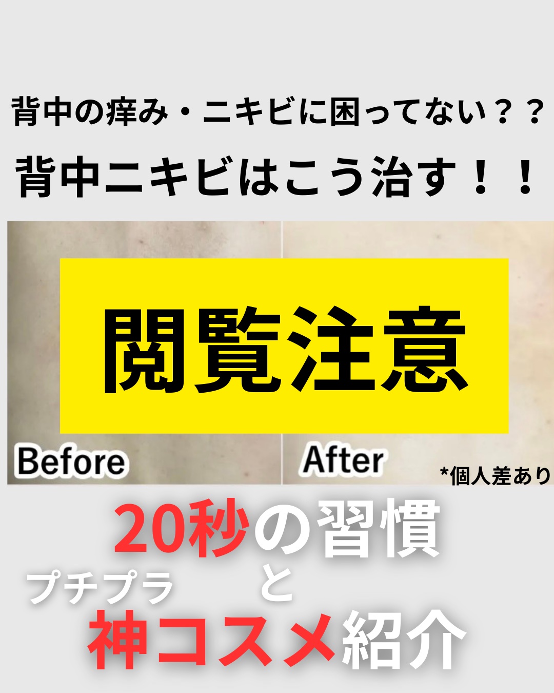モイストジェルN /HISKIN/ボディローションを使ったクチコミ（1枚目）