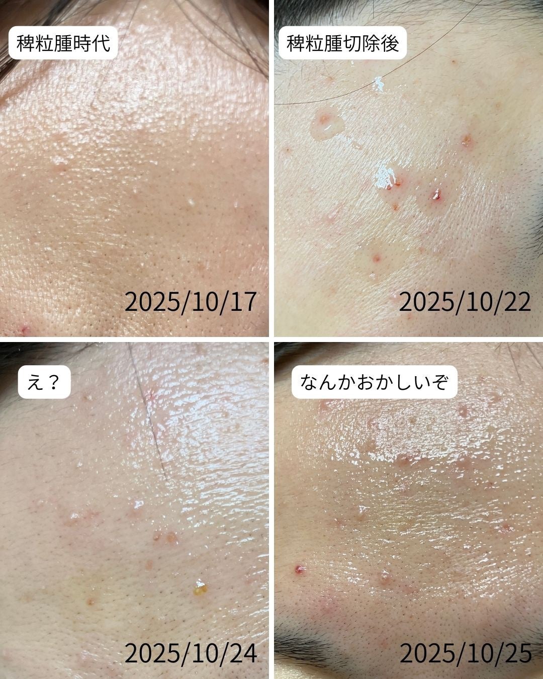 鼻セレブ 洗顔専用/ネピア/クレンジングタオルを使ったクチコミ(9枚目)