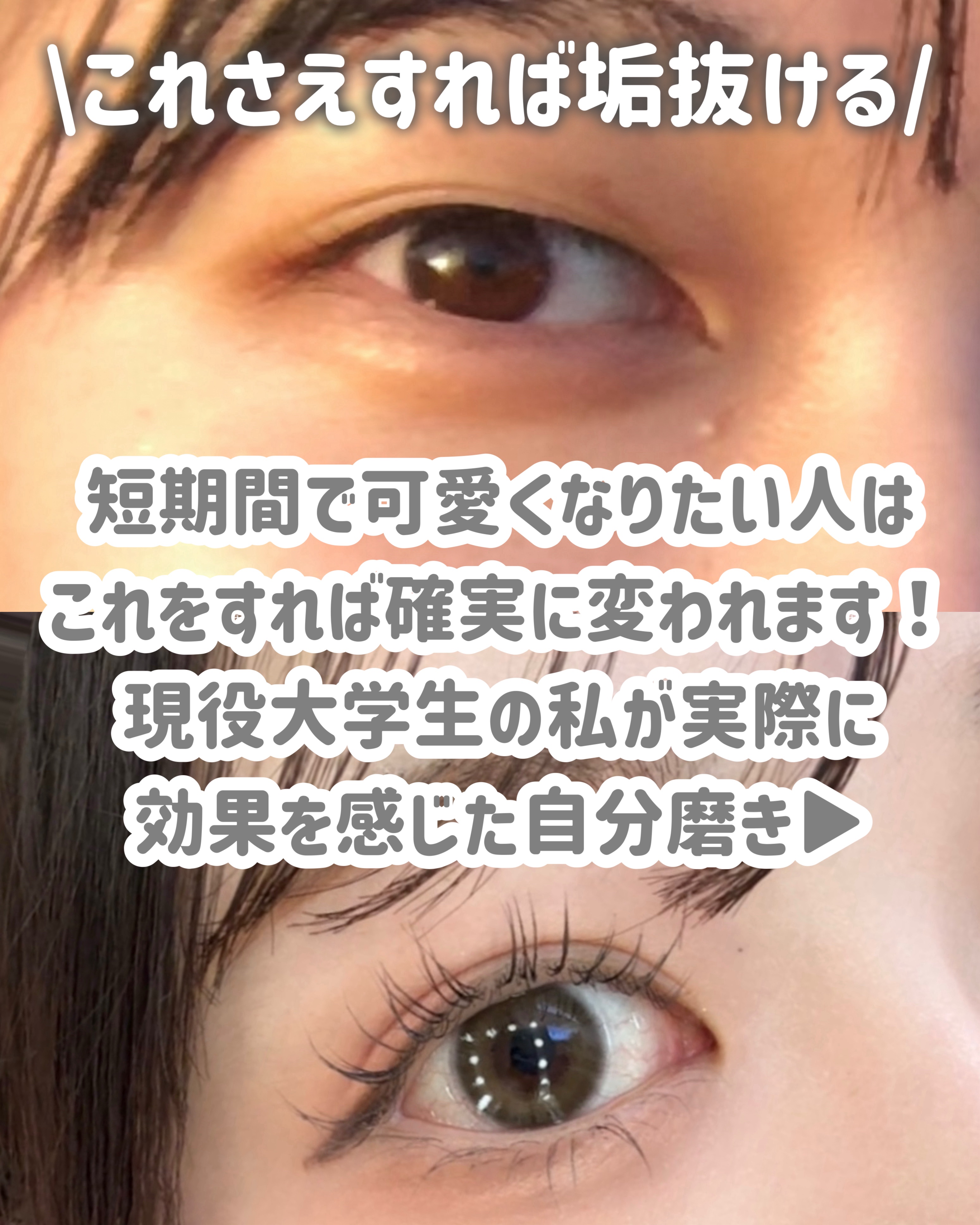 脱色クリーム 敏感肌用/エピラット/ムダ毛ケアを使ったクチコミ（2枚目）