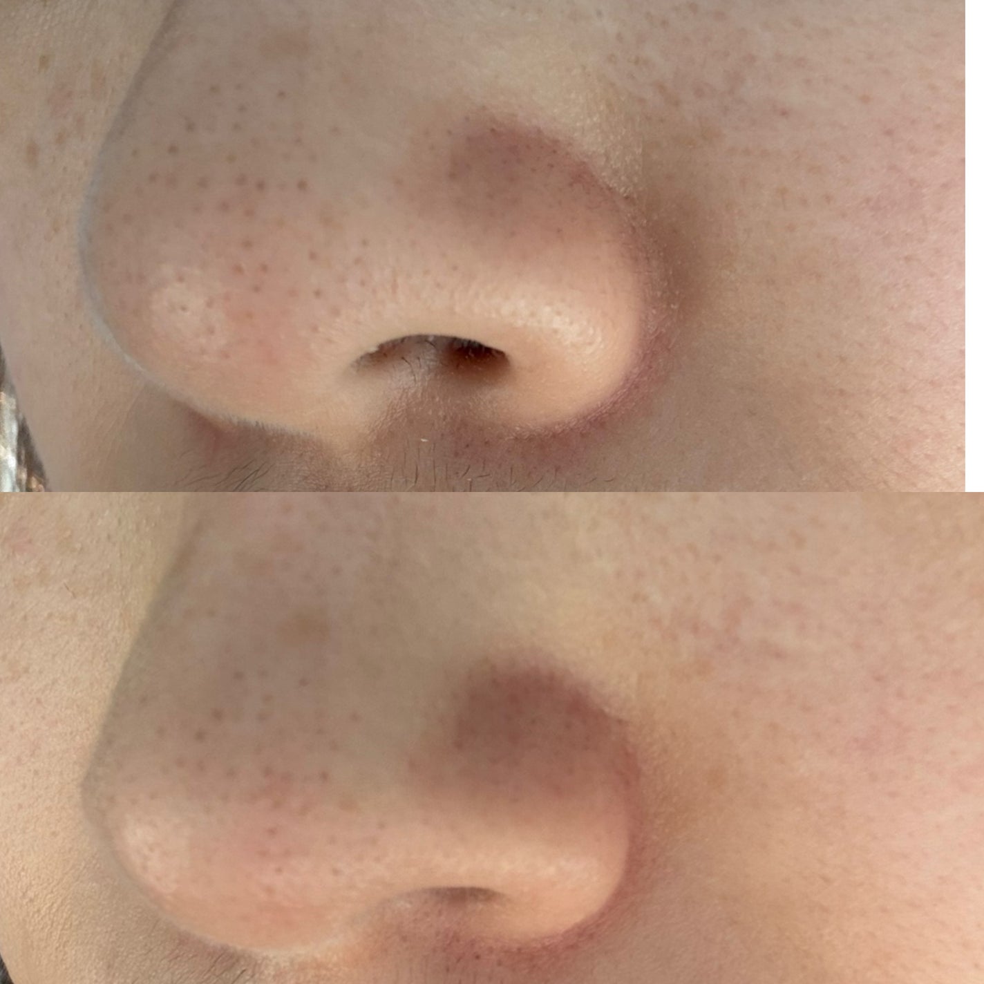 グラインドビタクレンジングバーム/FREBITS/クレンジングバームを使ったクチコミ(4枚目)