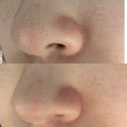 グラインドビタクレンジングバーム/FREBITS/クレンジングバームを使ったクチコミ(4枚目)