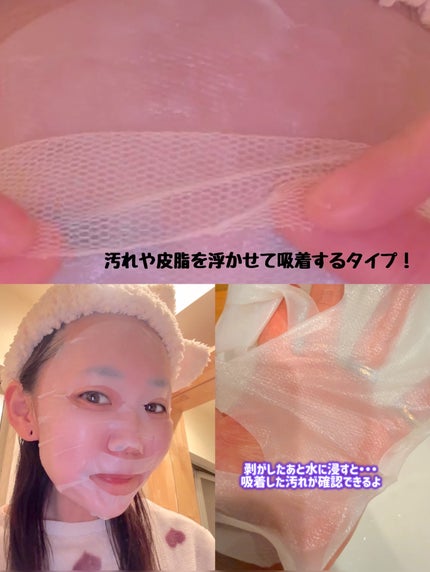 トラブルパッチマスク/EIOM/その他スキンケアを使ったクチコミ(6枚目)