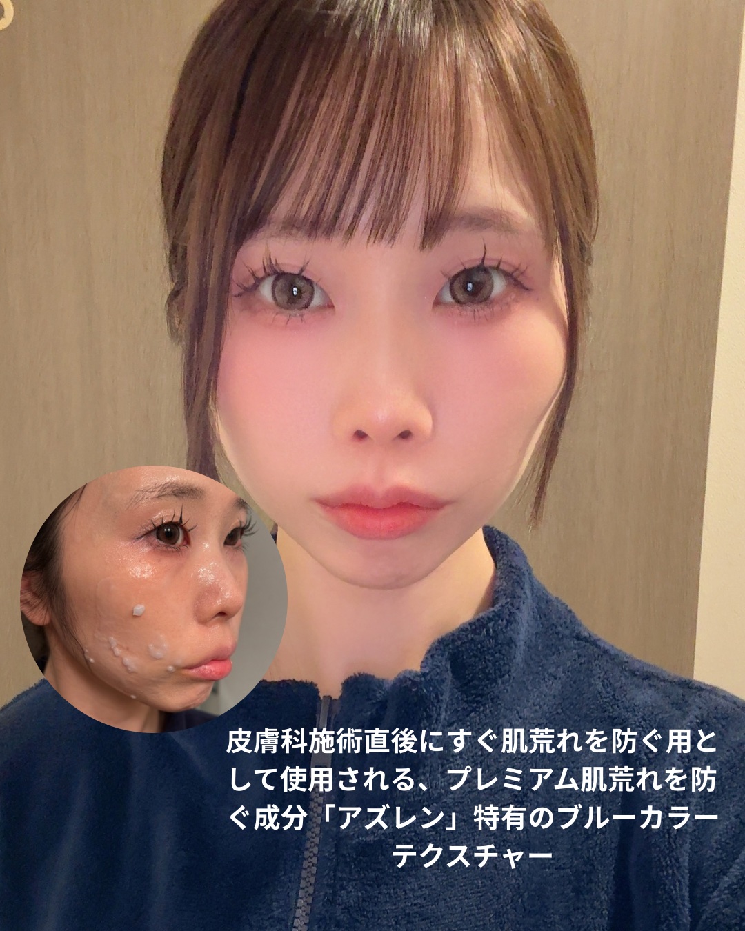 アズレンブルークレンジングバーム/原料工房/クレンジングバームを使ったクチコミ（3枚目）