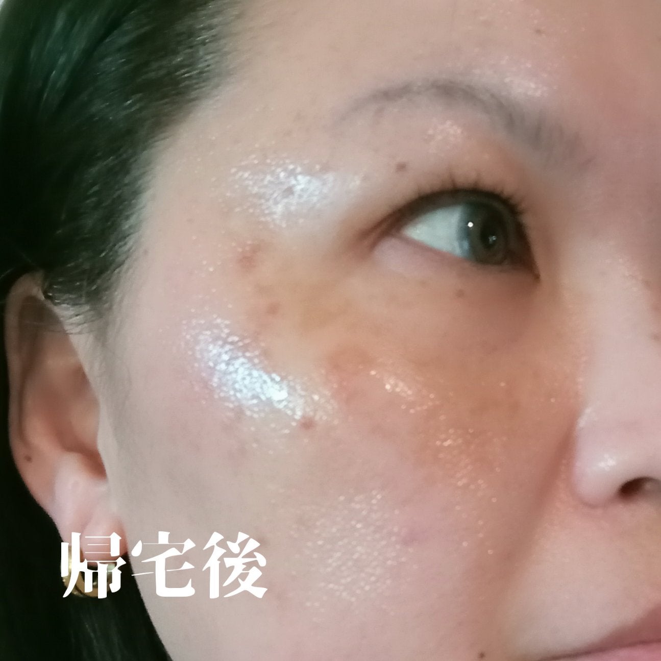 ビヨンセ奥二重向上委員長🥸LIPSパートナー🥳 on LIPS 「【つばきスキンクリニック】青葉台に12月に新しくできたクリニッ..」(5枚目)