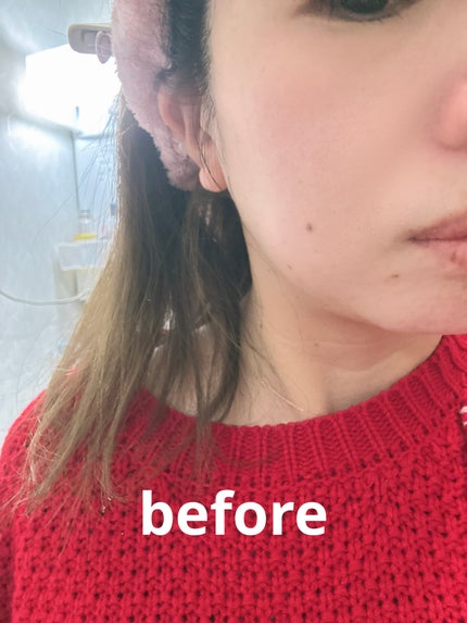 みい on LIPS 「C×AZ ダーマインショット200使用感としては伸びが良く1包..」(3枚目)