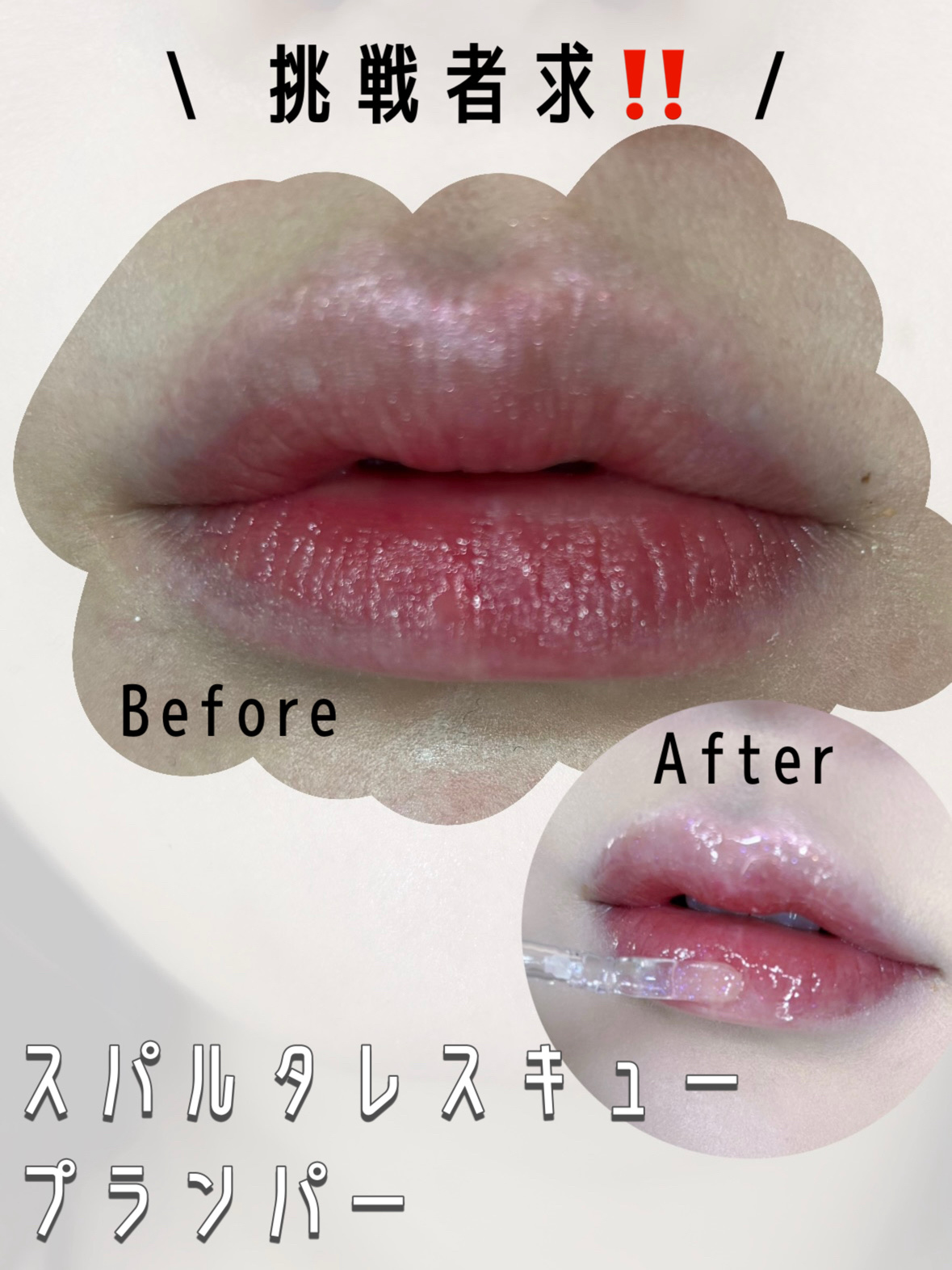 フレイムライトリッププランパー/LoNLy /リッププランパーを使ったクチコミ（1枚目）