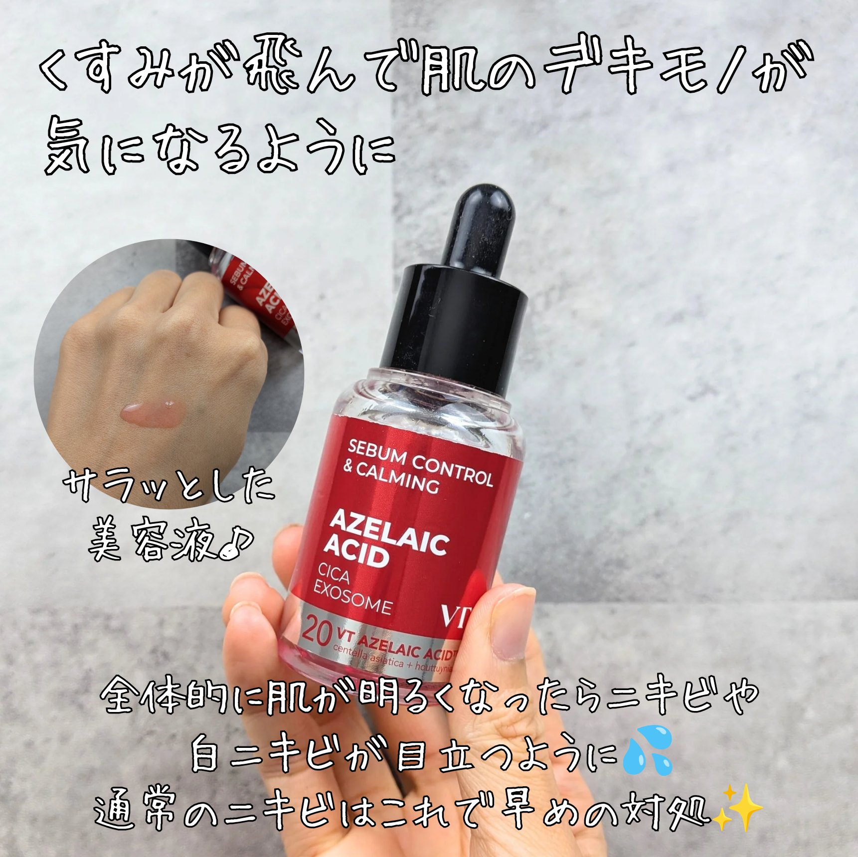 アクリンゲル/東亜製薬/その他スキンケアを使ったクチコミ（3枚目）