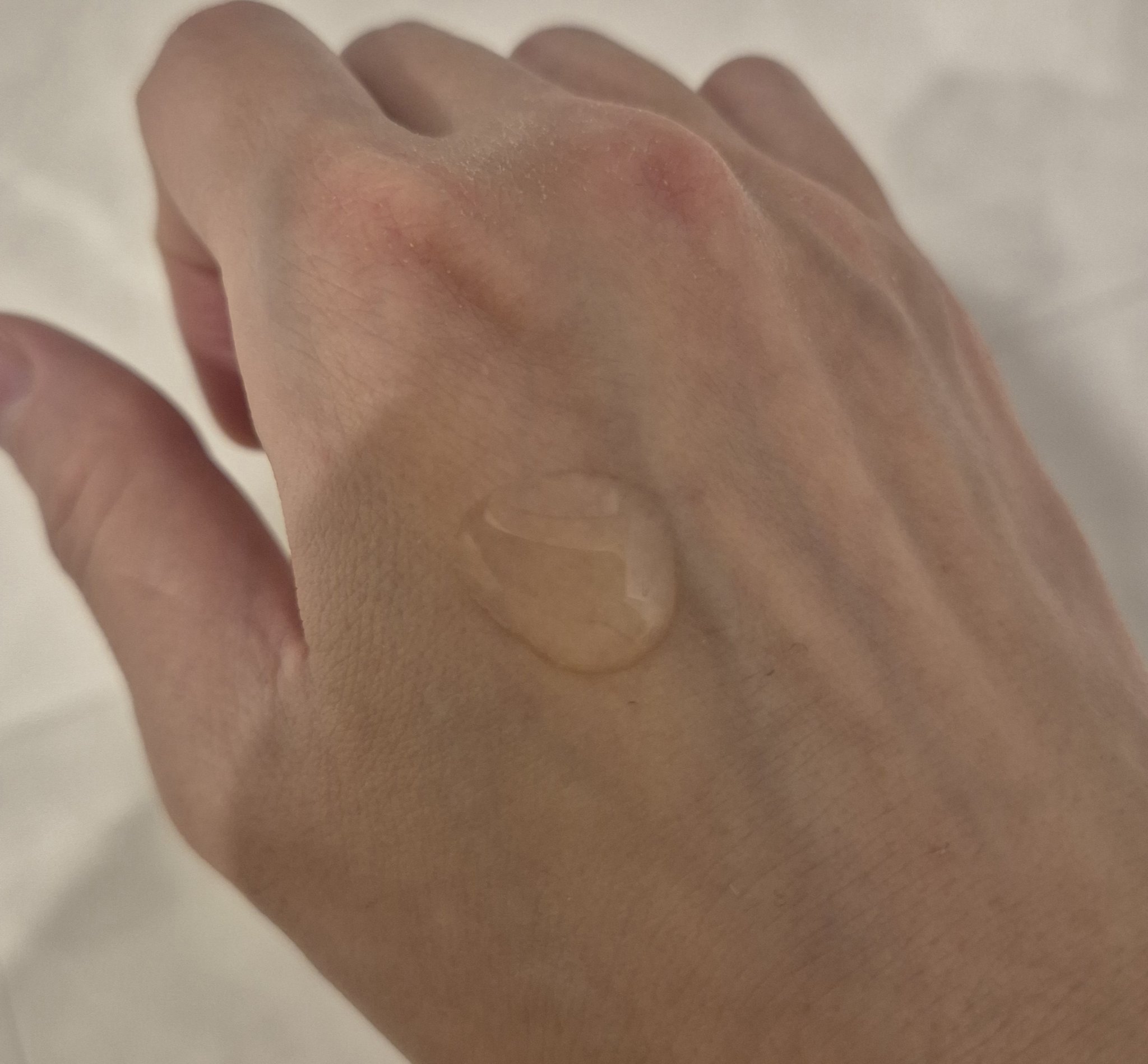 5 PDRN コラーゲン インテンス バイタライジング セラム/COSRX/美容液を使ったクチコミ（2枚目）