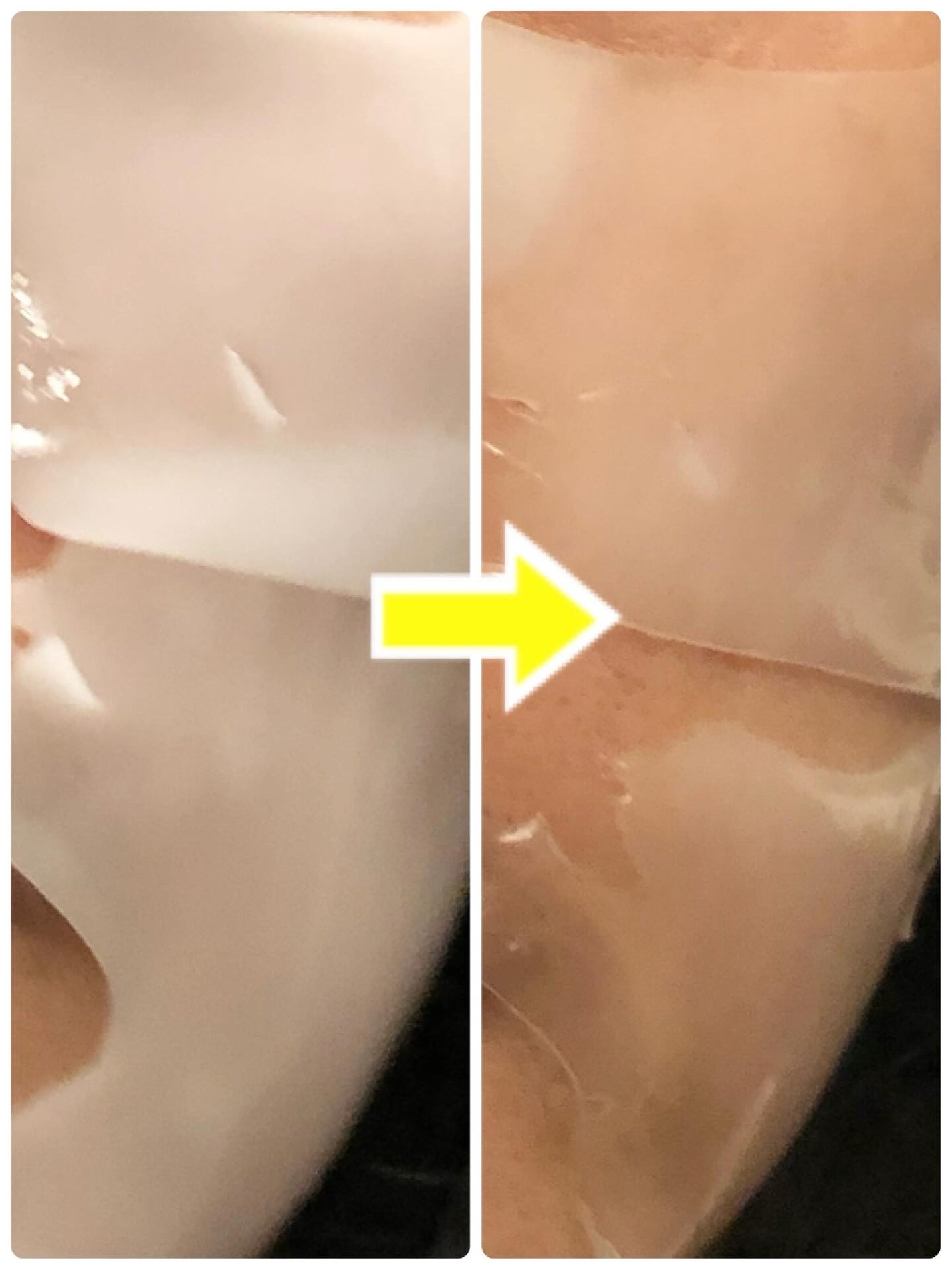 シグニチャーバイオディープコラーゲンファーミングマスク/VINNE /シートマスク・パックを使ったクチコミ(5枚目)