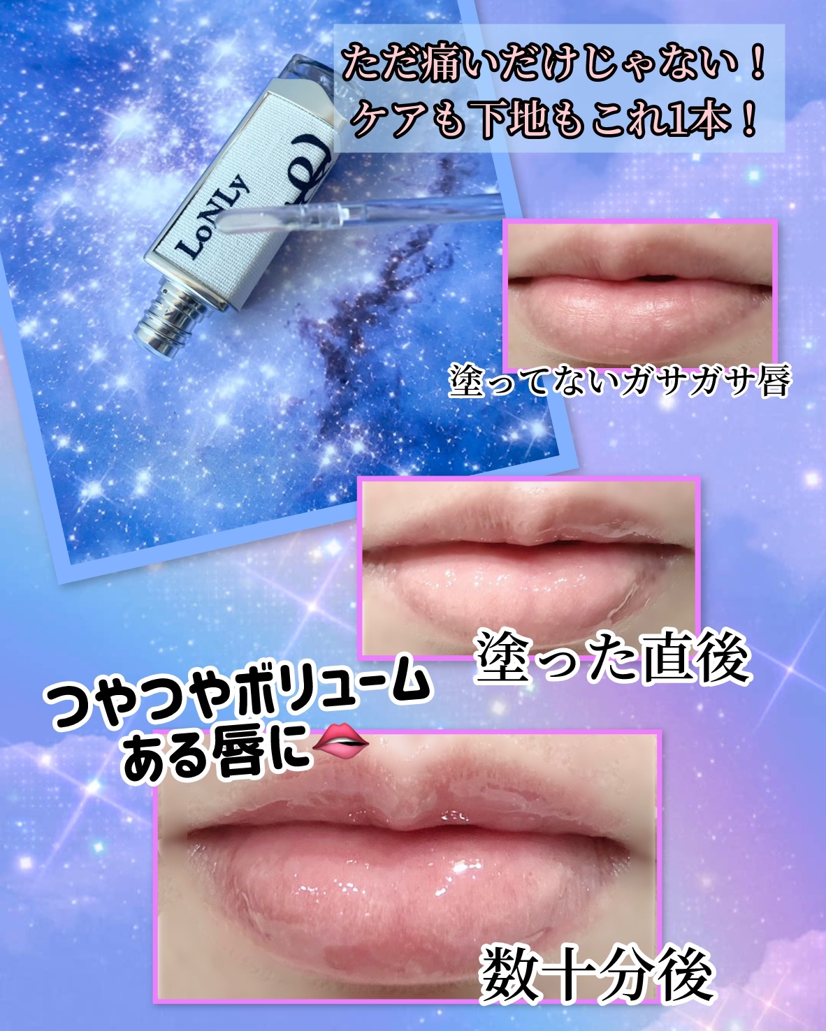 フレイムライトリッププランパー/LoNLy /リッププランパーを使ったクチコミ（2枚目）