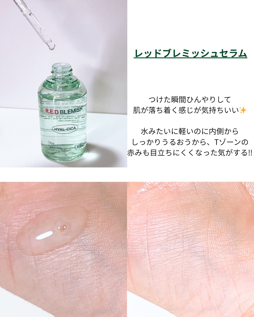 レッドブレミッシュ クリアスージングクリーム/Dr.G/フェイスクリームを使ったクチコミ（2枚目）