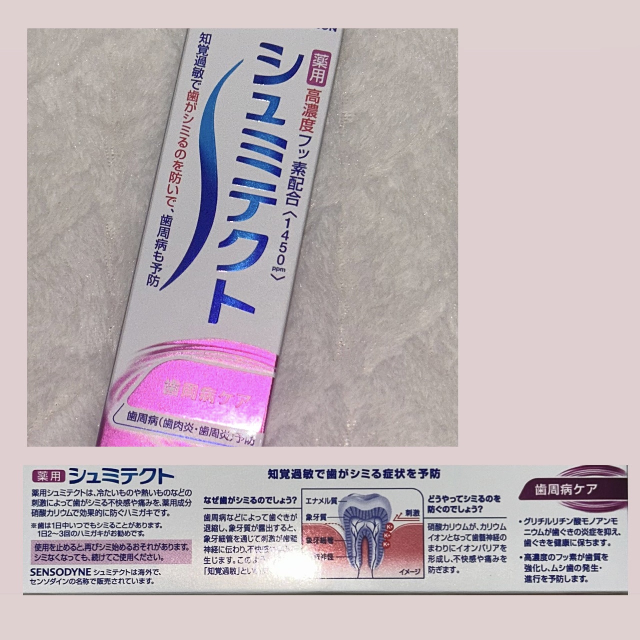 薬用シュミテクト 歯周病ケア/シュミテクト/歯磨き粉を使ったクチコミ（1枚目）