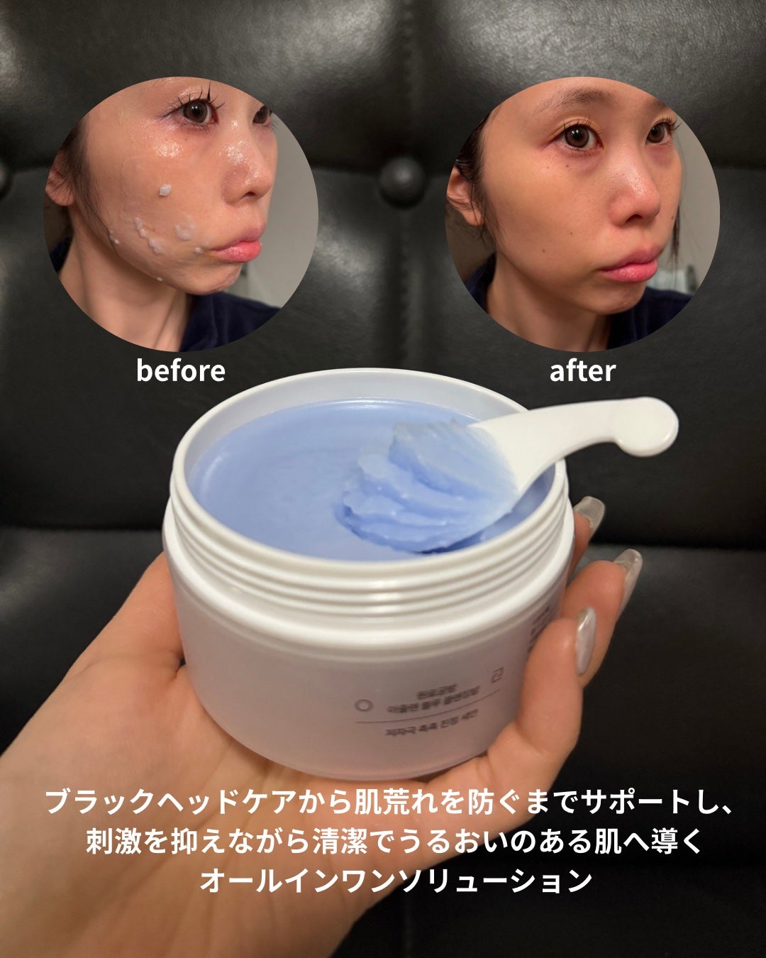 アズレンブルークレンジングバーム/原料工房/クレンジングバームを使ったクチコミ(4枚目)