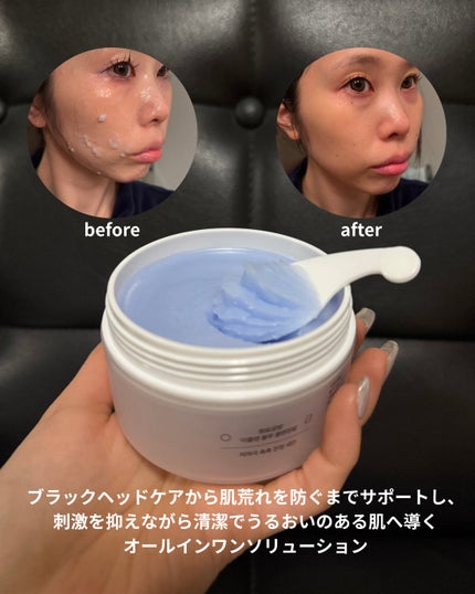 アズレンブルークレンジングバーム/原料工房/クレンジングバームを使ったクチコミ(4枚目)