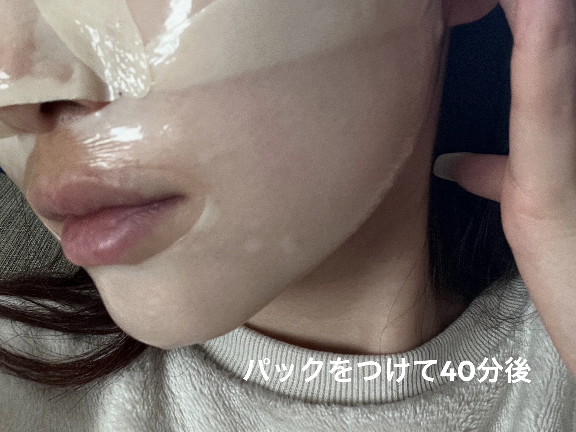 パーフェクト リアル パフォーマンス ビタコラーゲ ンマスクパック /ダーマフィックス/シートマスク・パックを使ったクチコミ（3枚目）