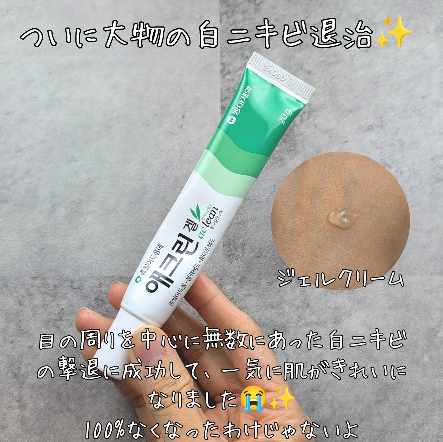 アクリンゲル/東亜製薬/その他スキンケアを使ったクチコミ(4枚目)