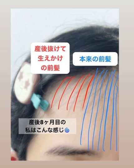 まとめ髪スティック スーパーホールド/マトメージュ/ヘアワックス・クリームを使ったクチコミ(2枚目)