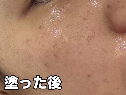 C×AZ ダーマインショット200/ESIENCE/美容液を使ったクチコミ(6枚目)