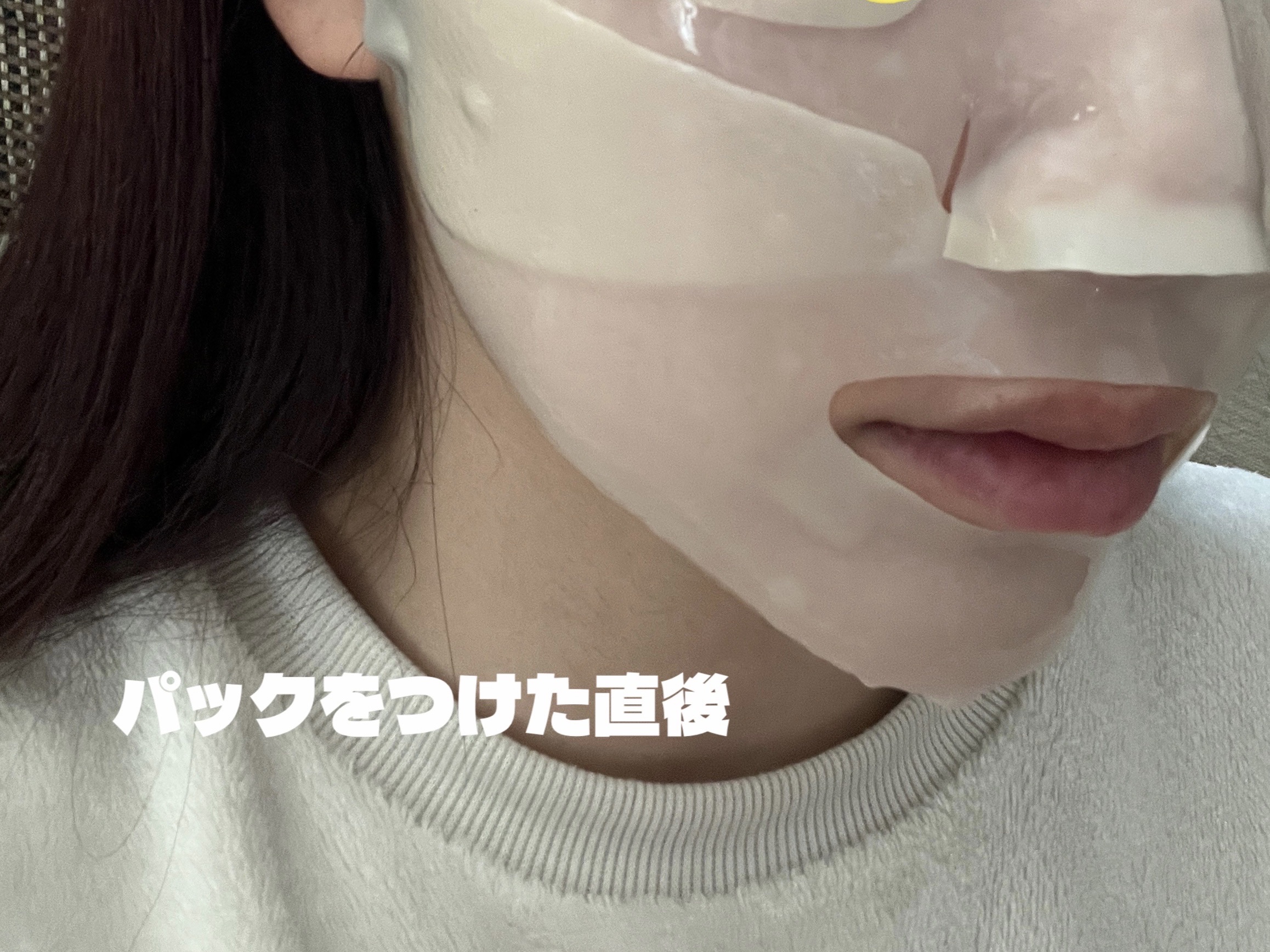 パーフェクト リアル パフォーマンス ビタコラーゲ ンマスクパック /ダーマフィックス/シートマスク・パックを使ったクチコミ（2枚目）