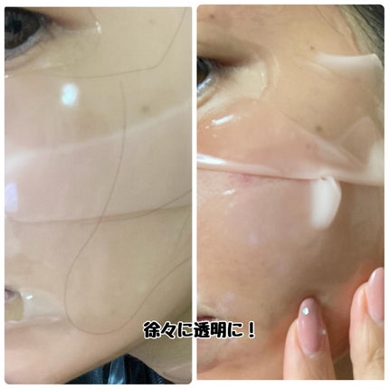 PDRNリジュべネティングフルインハイドロゲルマスク/SAM'U/シートマスク・パックを使ったクチコミ(3枚目)