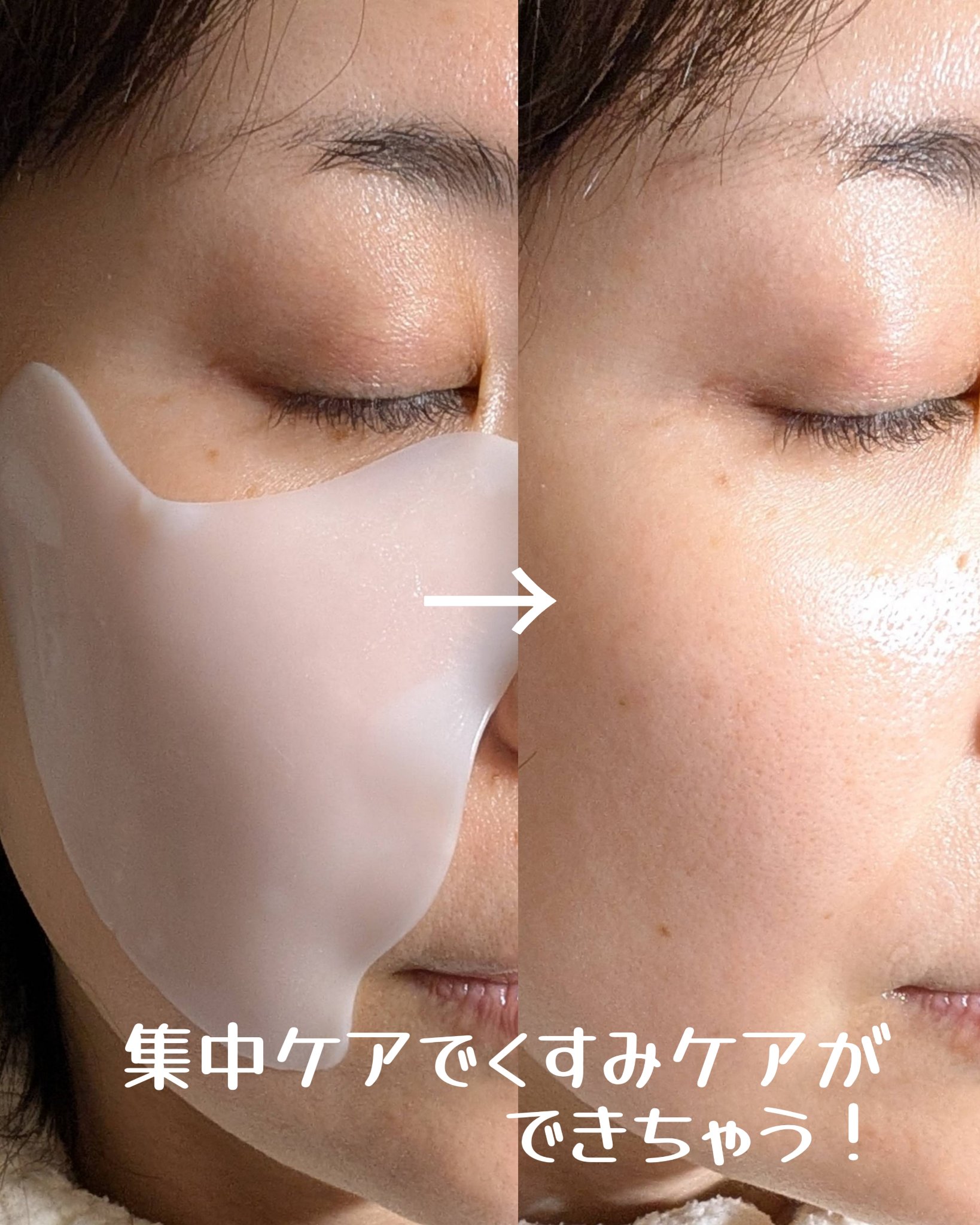 ビタソームショットホワイトニングフィルム/NEWYSIS/シートマスク・パックを使ったクチコミ（3枚目）