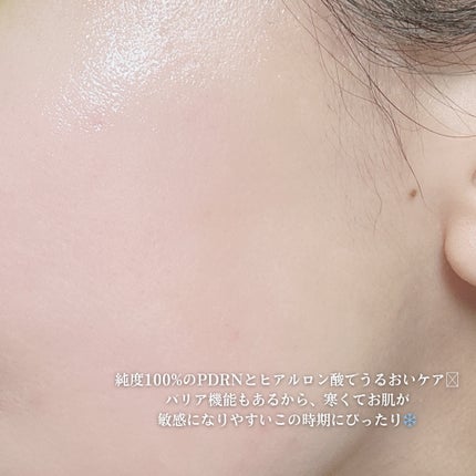 ハイパーPDRN リペア アンプル/Wellage/美容液を使ったクチコミ(3枚目)