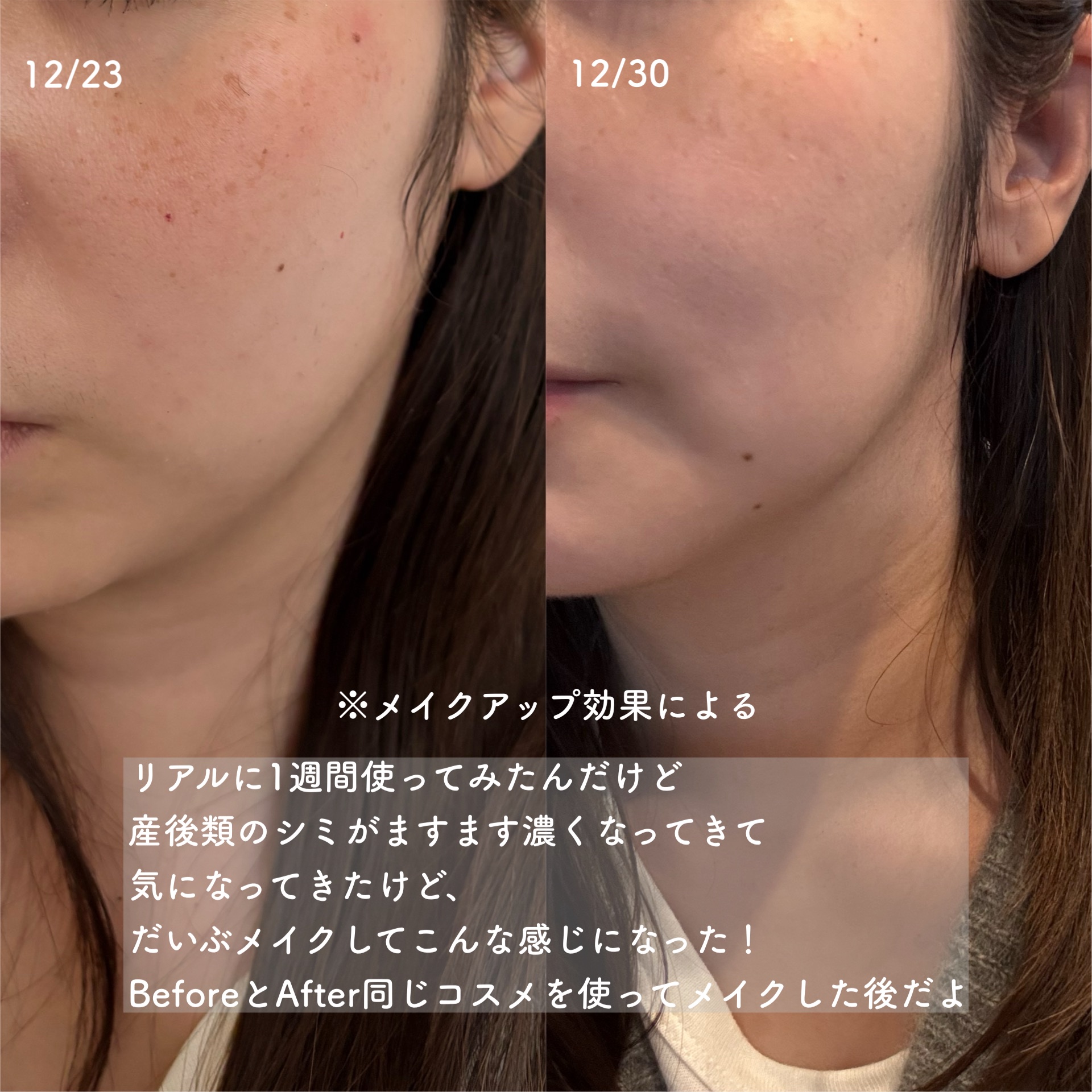 5番 白玉グルタチオンCメラゼロクリーム/numbuzin/フェイスクリームを使ったクチコミ（3枚目）