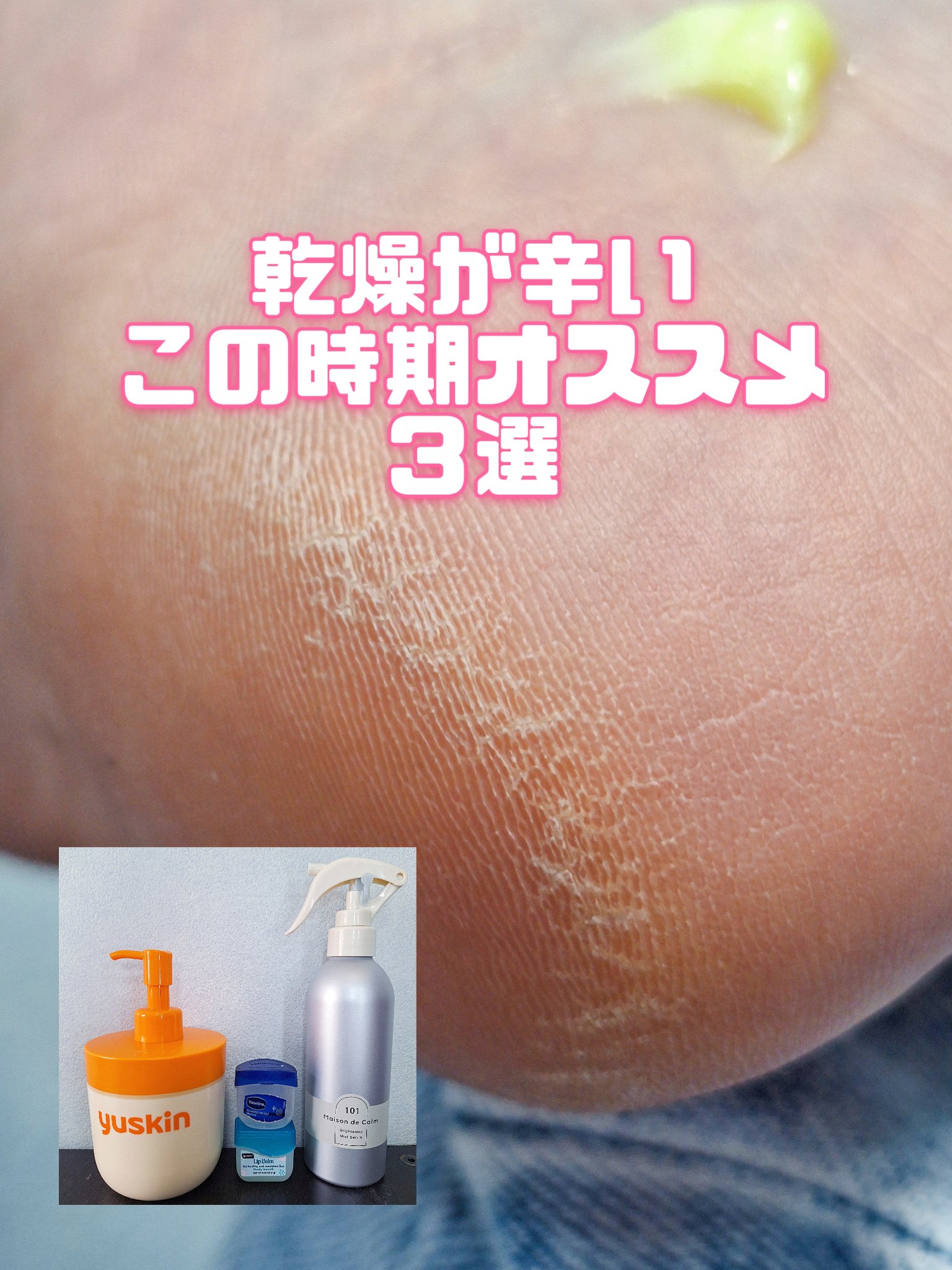 リップ オリジナル/ヴァセリン/リップバームを使ったクチコミ（1枚目）