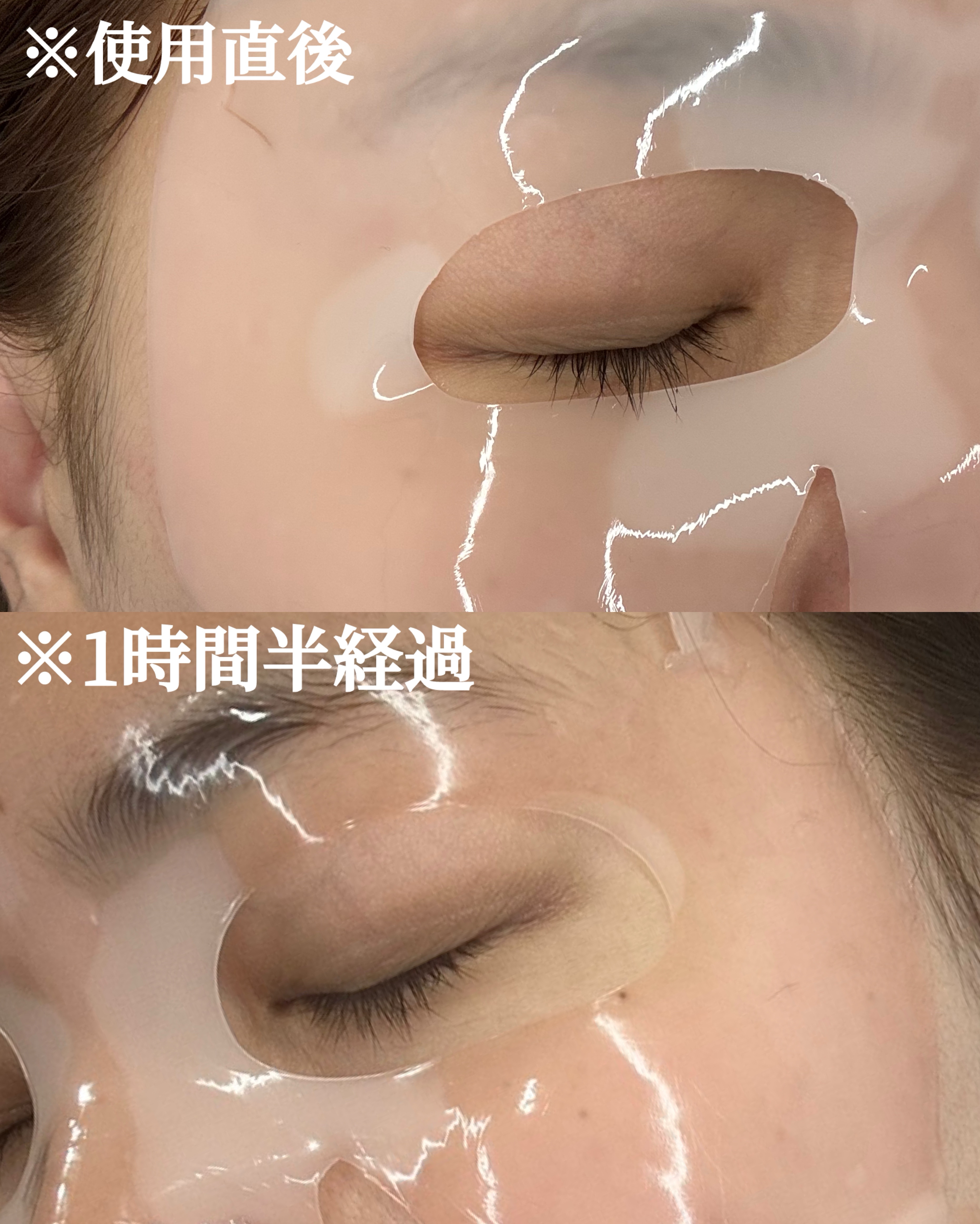 PDRNリジュべネティングフルインハイドロゲルマスク/SAM'U/シートマスク・パックを使ったクチコミ（3枚目）