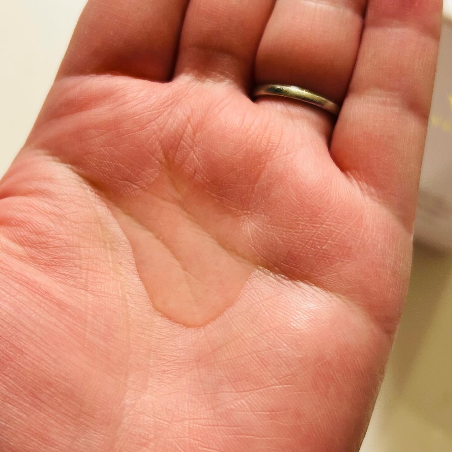 VERNO SKIN ローション〈医薬部外品〉/VERNO SKIN CARE/化粧水を使ったクチコミ（2枚目）