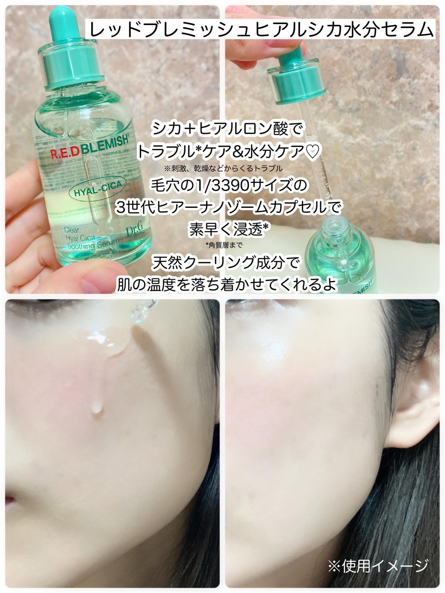 レッドブレミッシュ クリアスージングクリーム/Dr.G/フェイスクリームを使ったクチコミ(2枚目)